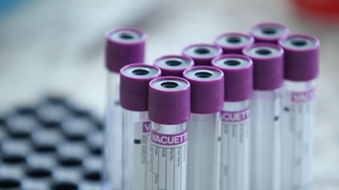 19 нови случая на COVID-19 в Кюстендил, квартал „Изток“ остава блокиран